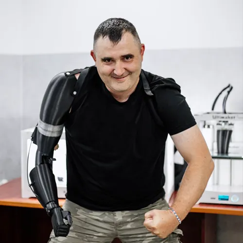 Тренувально-терапевтичний протез руки для Андрія Крамара від АРОЛ ПЛЮС